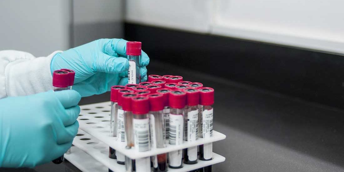 lab